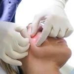 چه کسانی نباید از اندولیفت استفاده کنند؟