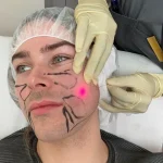 آیا اندولیفت عوارض جانبی دارد؟