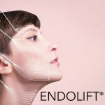 نتایج اندولیفت چه زمانی قابل مشاهده است؟