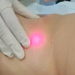 آیا اندولیفت برای بدن هم قابل استفاده است؟