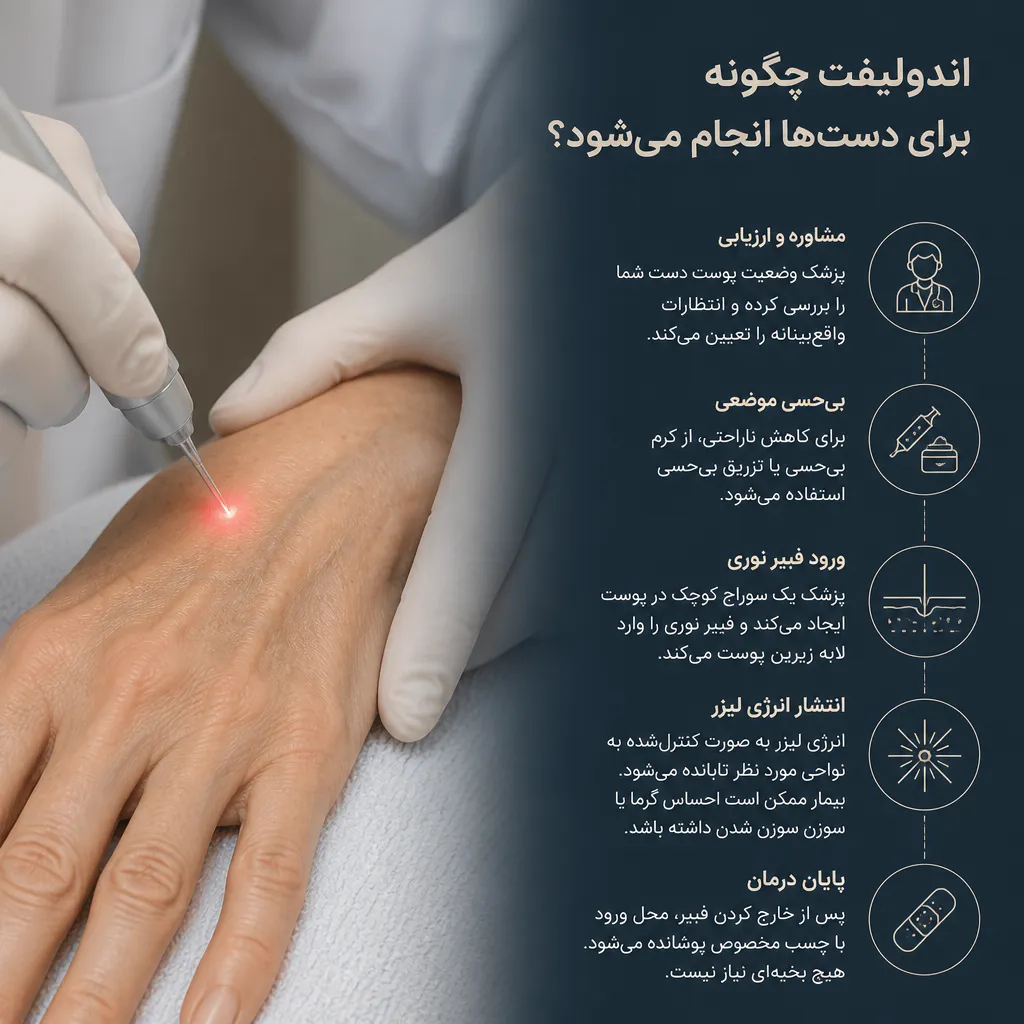 اندولیفت چگونه برای دستها انجام میشود؟