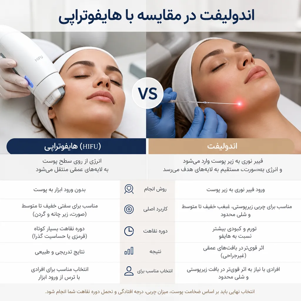 اندولیفت در مقایسه با هایفوتراپی