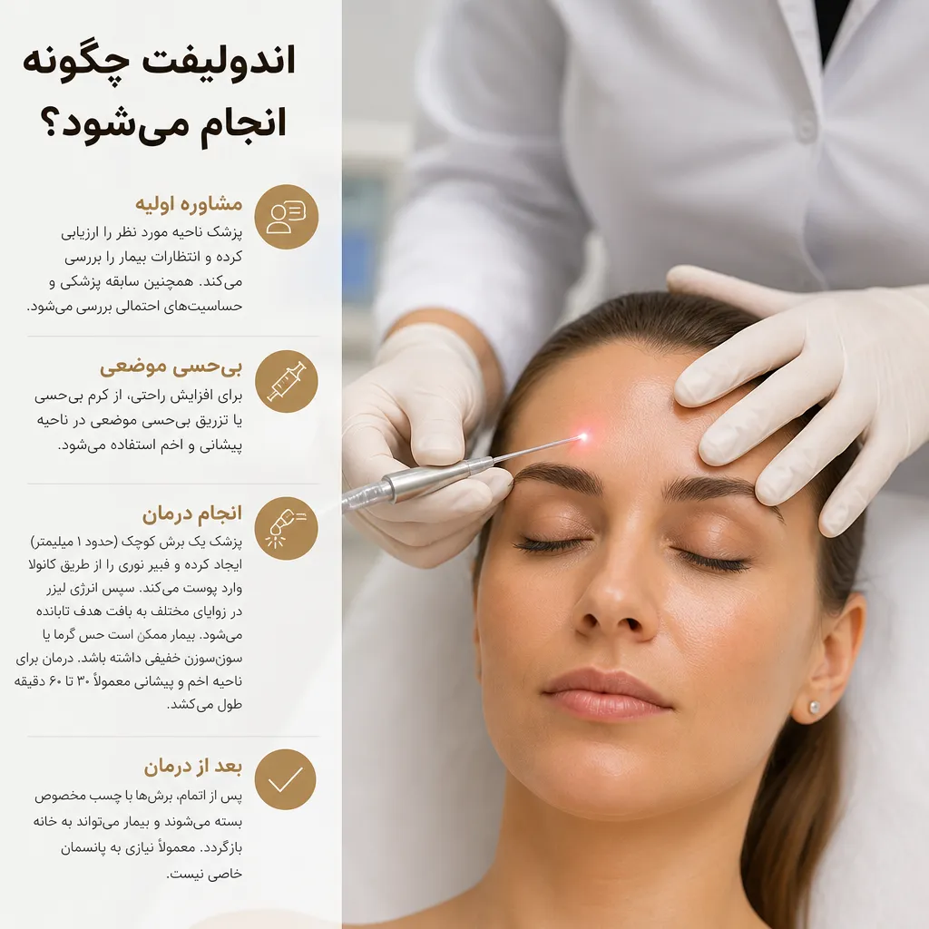 اندولیفت چگونه انجام میشود؟